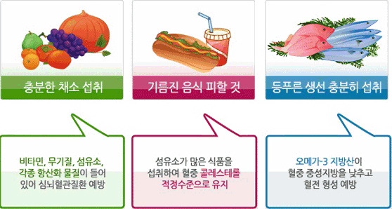 심뇌혈관질환을 예방방법 - 자세한 내용은 하단 참조